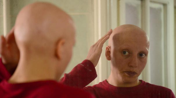 Saçsızlara hayati uyarı