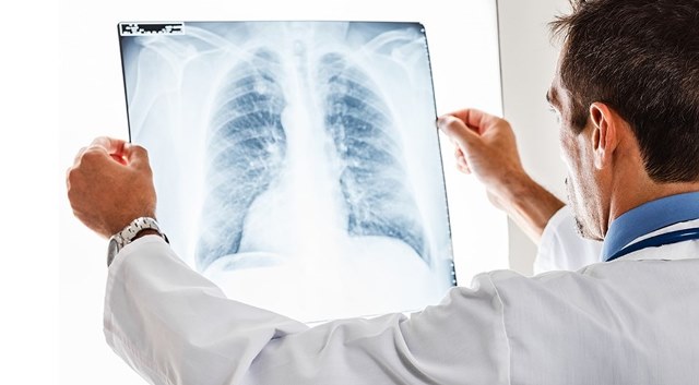 Akciğer kanserinin 7 belirtisi